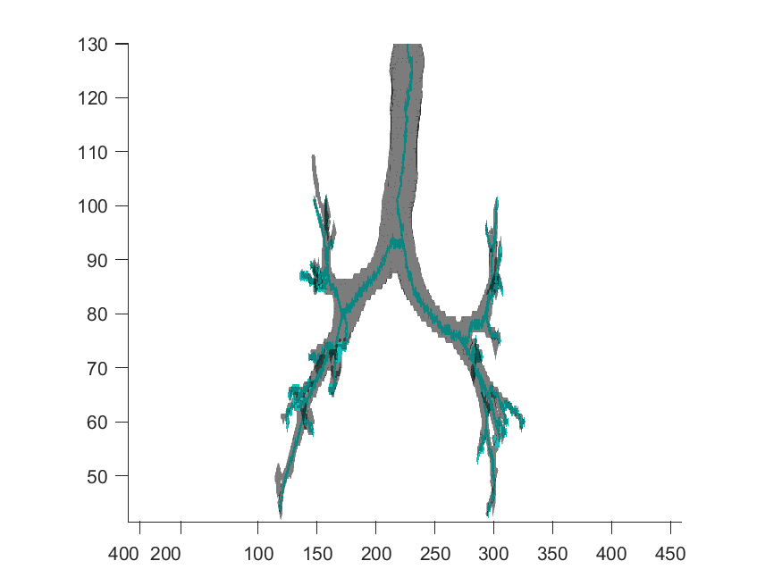 Example result of segskel